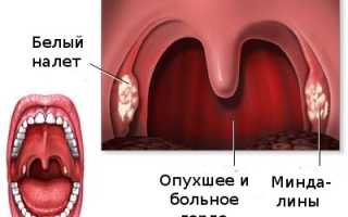 Можно ли при ангине пить алкоголь, как полоскать горло водкой и помогает ли горячее вино