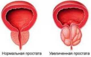 Можно ли вылечить простуду коньяком – лечение алкоголем