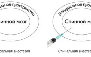 Почему нельзя есть и пить перед и после операции с наркозом